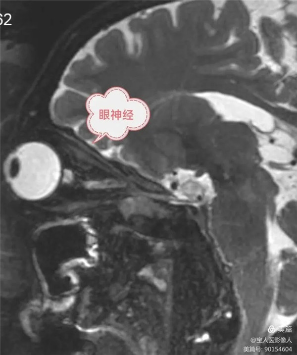 2.webp.jpg 2.webp.jpg