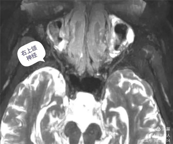 3.webp.jpg 3.webp.jpg