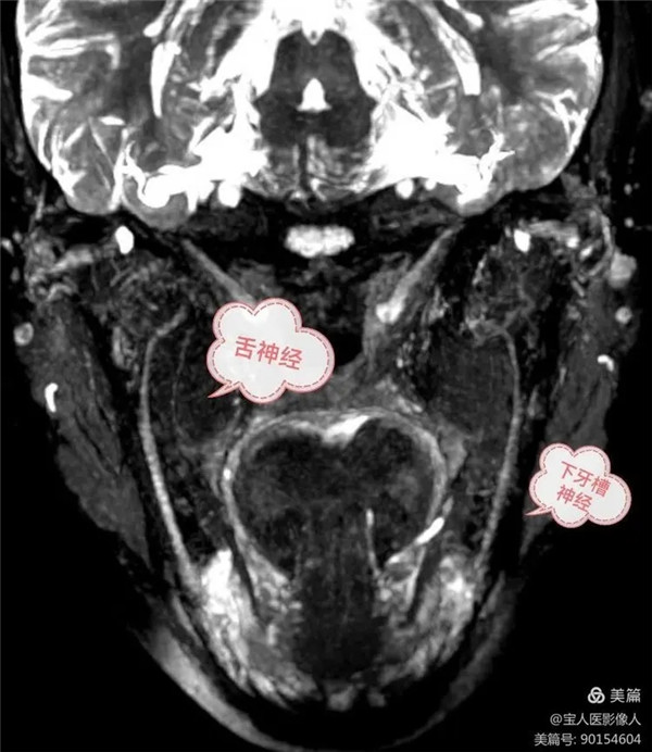 6.webp.jpg 6.webp.jpg