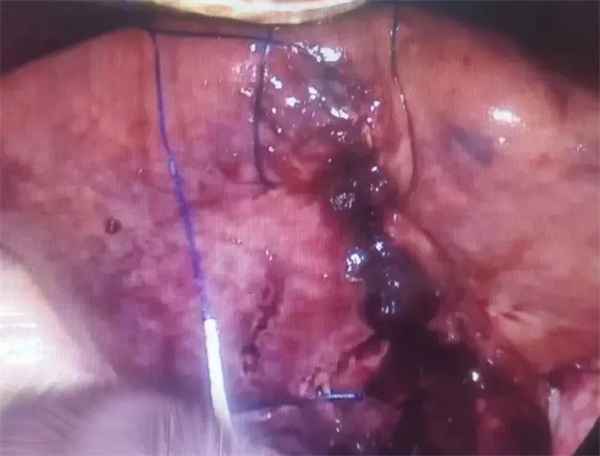 3.webp.jpg 3.webp.jpg