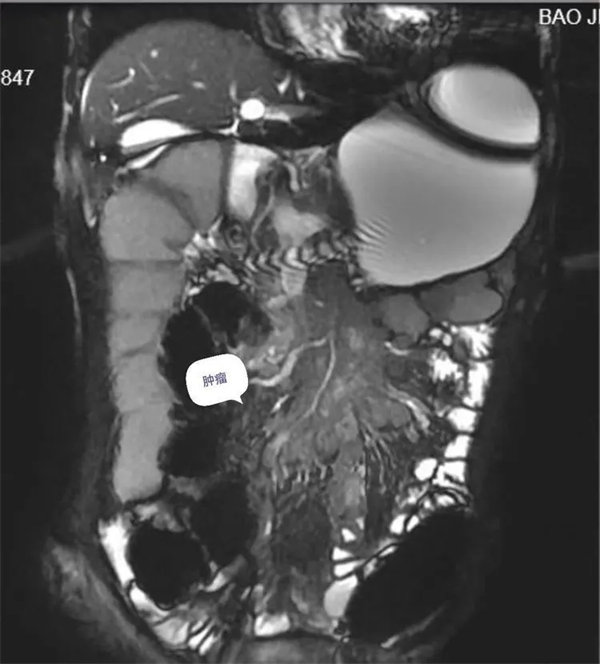 2.webp.jpg 2.webp.jpg