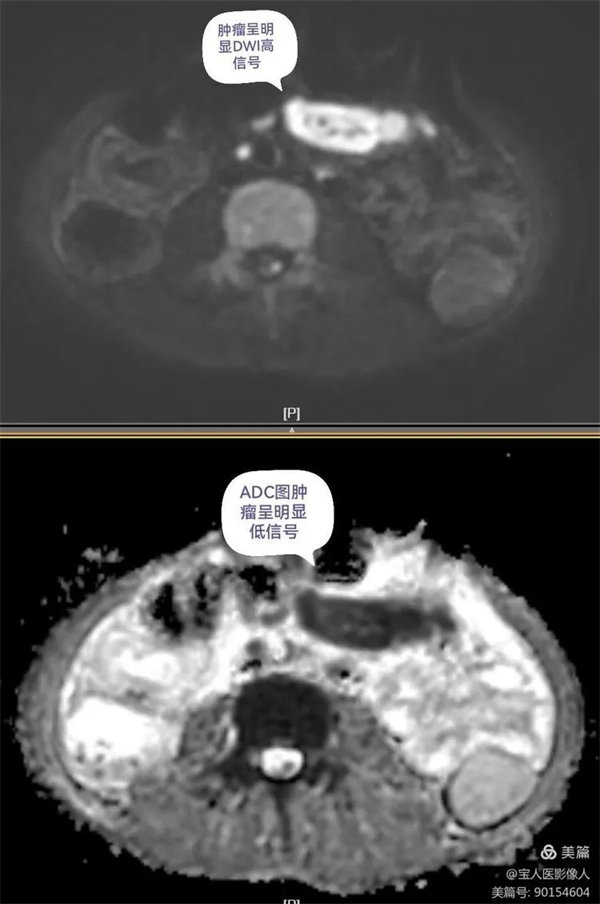 6.webp.jpg 6.webp.jpg