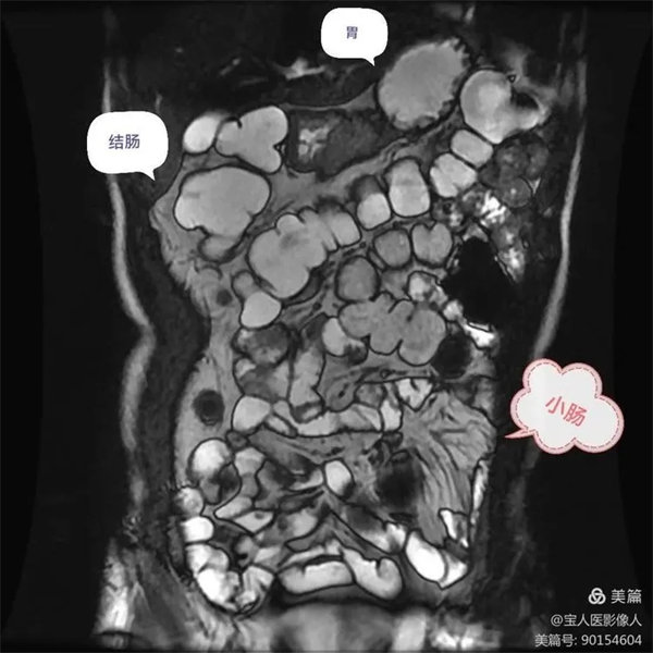 7.webp.jpg 7.webp.jpg