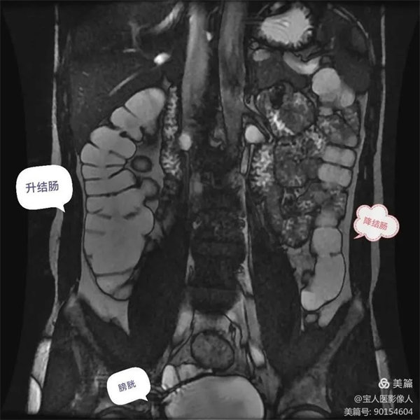 8.webp.jpg 8.webp.jpg