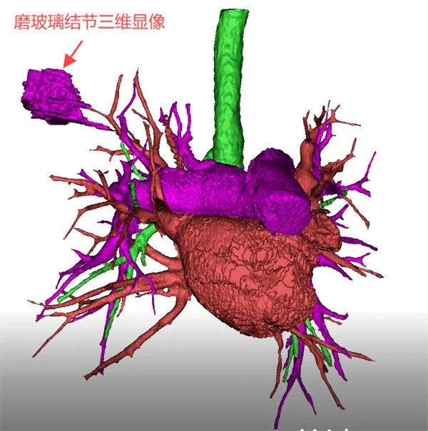 5.webp.jpg 5.webp.jpg