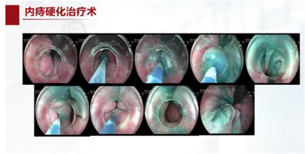 7.webp.jpg 7.webp.jpg