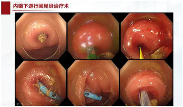 8.webp.jpg 8.webp.jpg