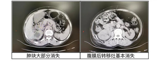 4.webp.jpg 4.webp.jpg